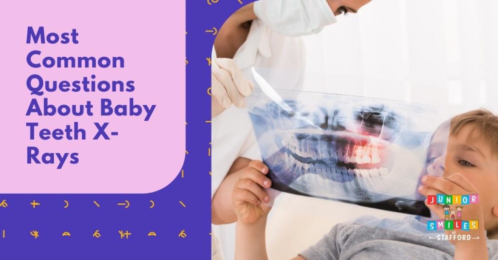 5 Most Common Questions About Baby Teeth X-Rays | Junior Smiles of Stafford