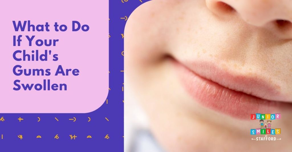 What to Do If Your Child's Gums Are Swollen | Junior Smiles of Stafford