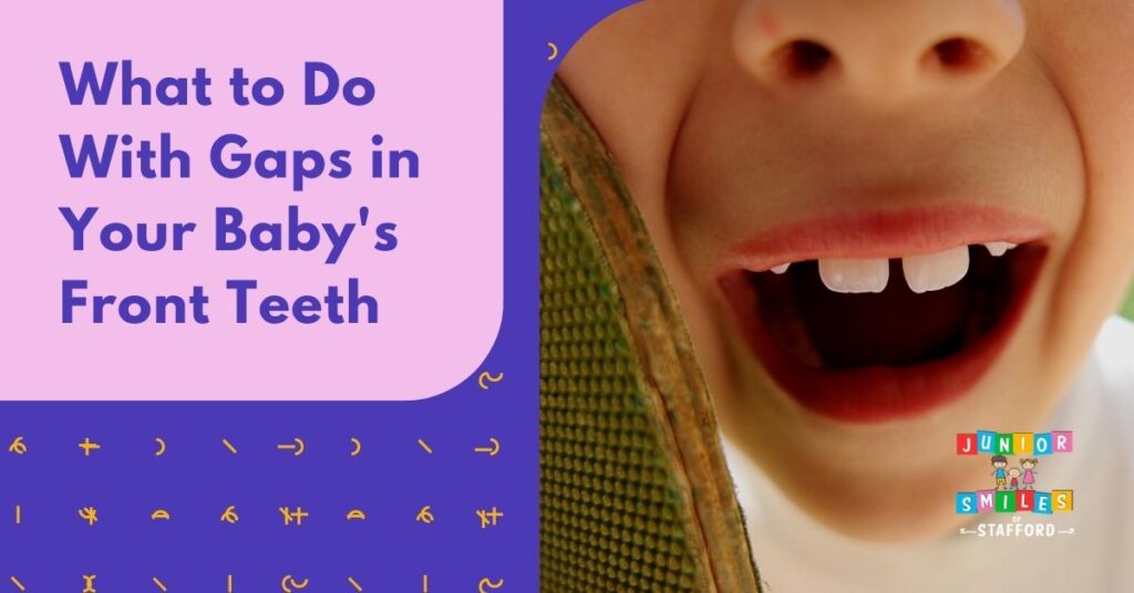 What To Do With Gaps In Your Baby s Front Teeth Junior Smiles Of Stafford