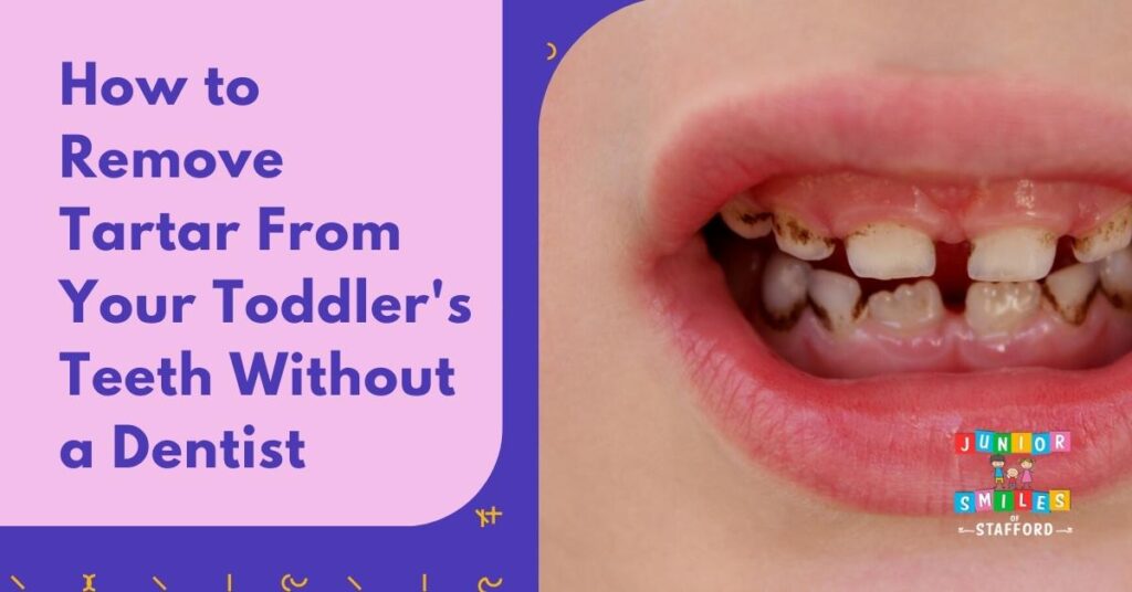 How to Clean Your Newborn's Tongue to Fight Off Gum Disease