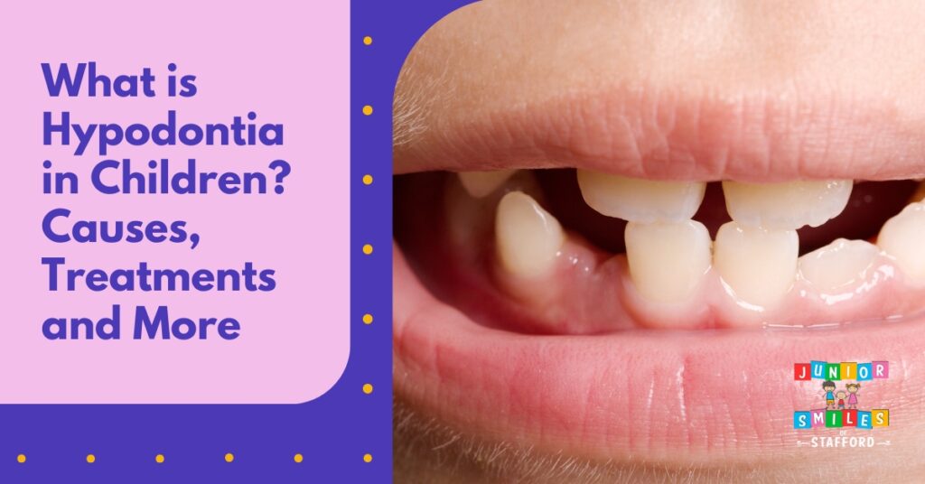 What is Hypodontia in Children? Causes, Treatments, and More